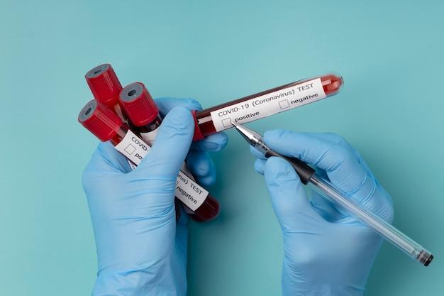  Экспресс-тест ВИЧ: какие риски связаны с доверием результатам?