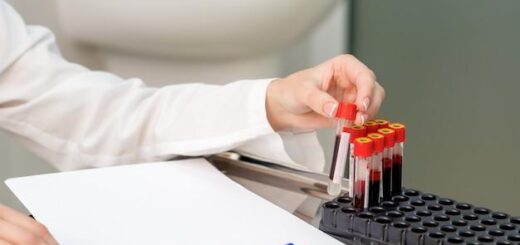 Доктор Стом | Можно ли доверять экспресс тестам на ВИЧ по крови