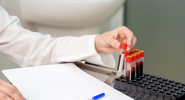 Доктор Стом | Можно ли доверять экспресс тестам на ВИЧ по крови